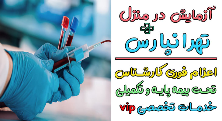 آزمایش در منزل تهرانپارس