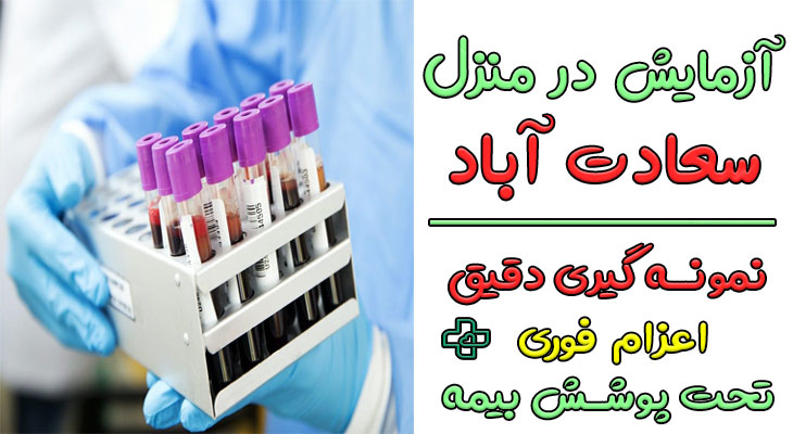 آزمایش در منزل سعادت آباد