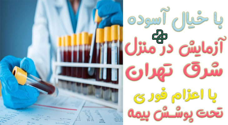 آزمایش در منزل شرق تهران