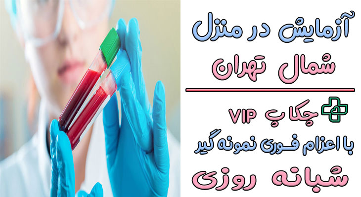 آزمایش در منزل شمال تهران