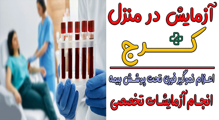 آزمایش در منزل کرج