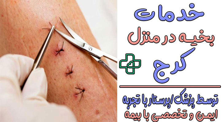 بخیه در منزل کرج و کشیدن بخیه در منزل کرج