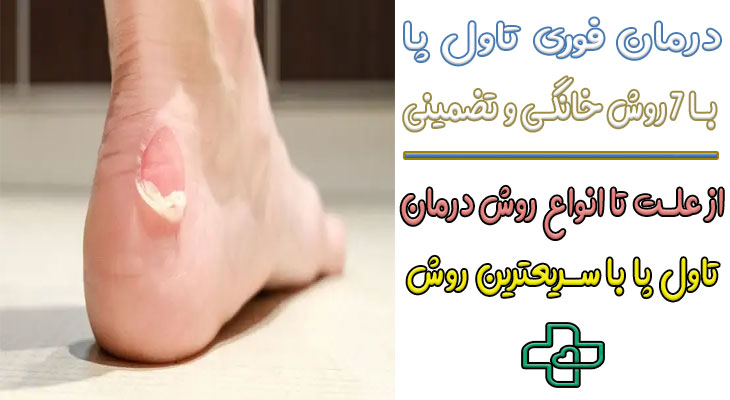درمان فوری تاول پا