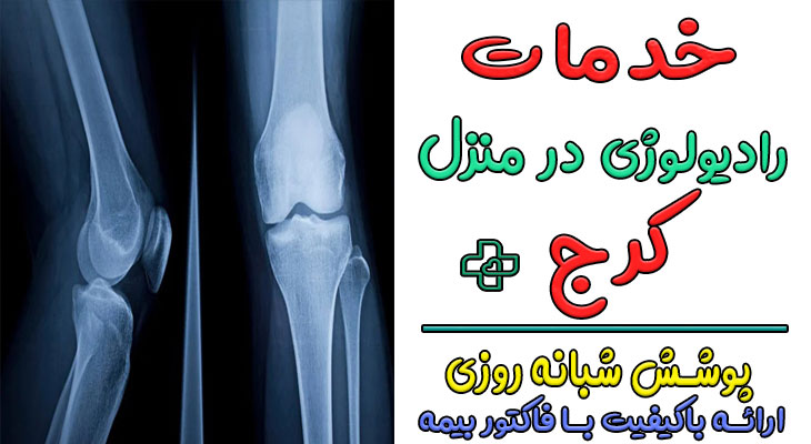 رادیولوژی در منزل کرج