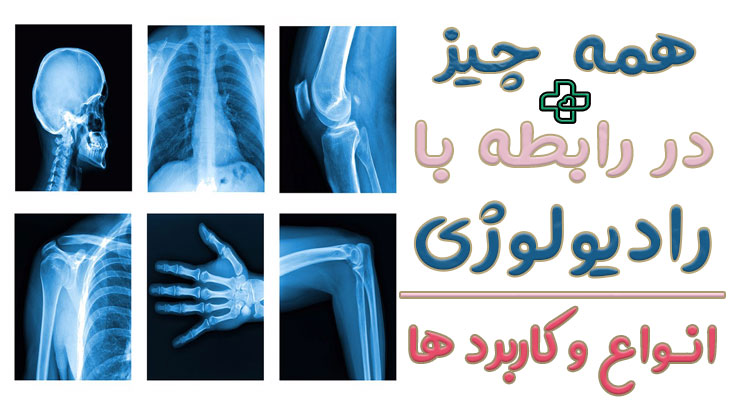 رادیولوژی و نکات مهم آن