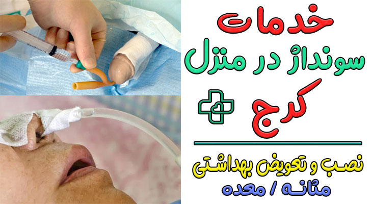 سونداژ در منزل کرج (نصب و تعویض سوند ادرار و معده)