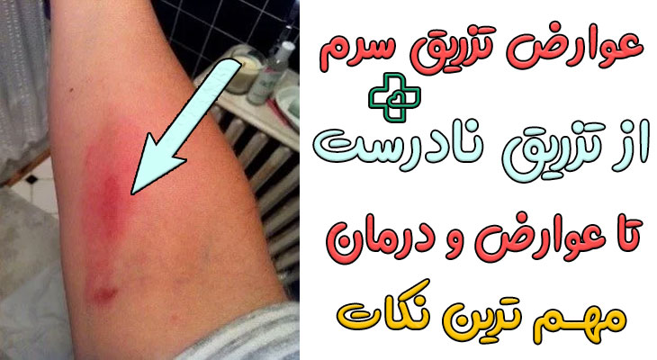عوارض تزریق سرم