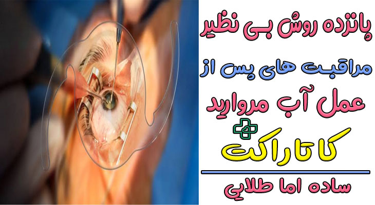 مراقبت های بعد از عمل آب مروارید چشم