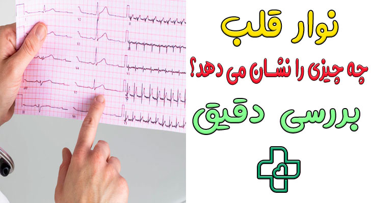 نوار قلب چه چیزی را نشان می دهد؟