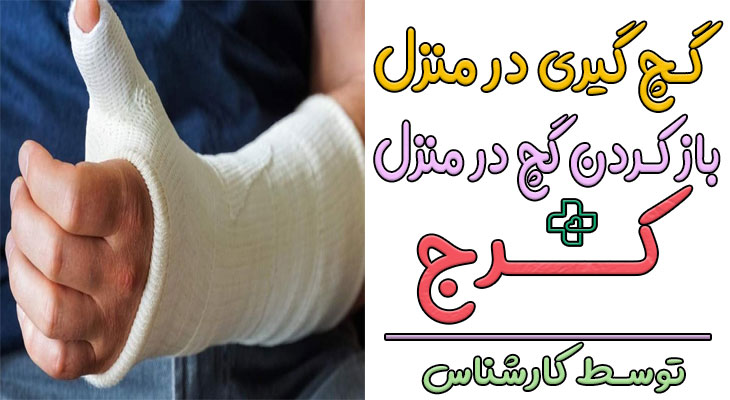 گچ گیری در منزل کرج و باز کردن گچ در منزل کرج