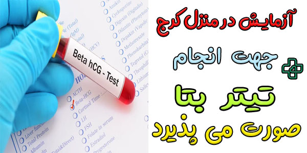 آزمایش بارداری در منزل کرج