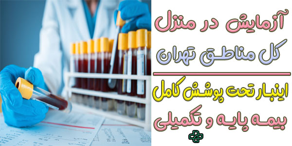 آزمایش در منزل