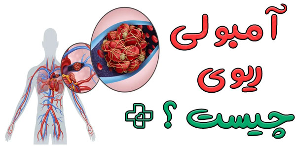 آمبولی ریه چیست؟