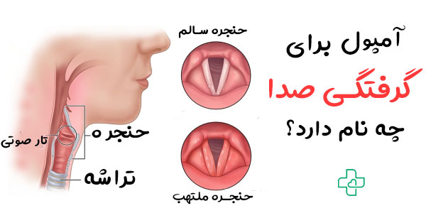 آمپول برای گرفتگی صدا چه نام دارد؟