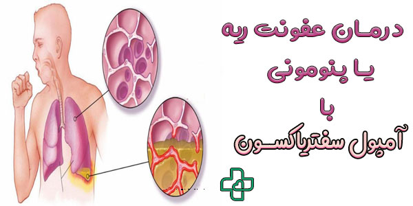 آمپول سفتریاکسون برای عفونت ریه