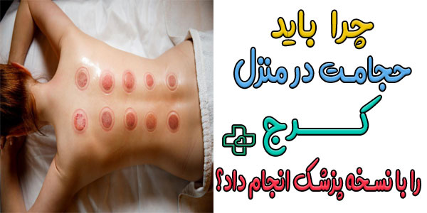 آیا برای انجام حجامت در منزل کرج نیاز به نسخه پزشک داریم؟