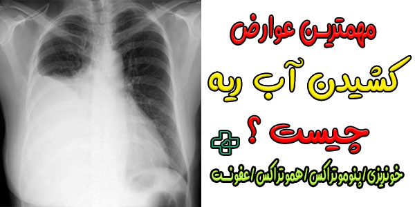 آیا تخلیه آب ریه در منزل عوارضی دارد؟