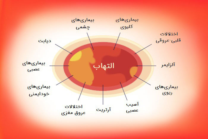 التهابات و تزریق بتامتازون