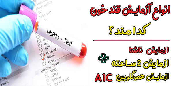 انواع آزمایش قند خون به چند دسته تقسیم می شوند؟ (اسم قند خون در آزمایش)