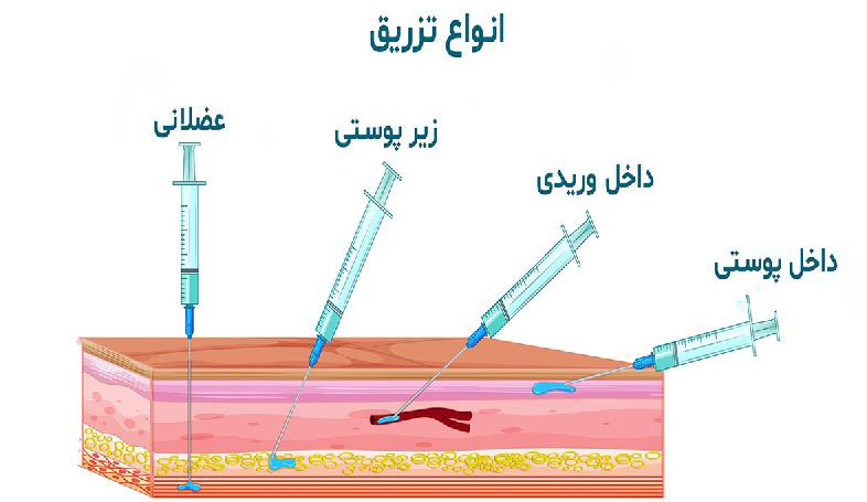 انواع تزریق