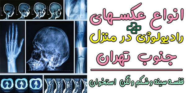 انواع تصاویر حاصله از اجرای خدمات رادیولوژی در منزل جنوب تهران