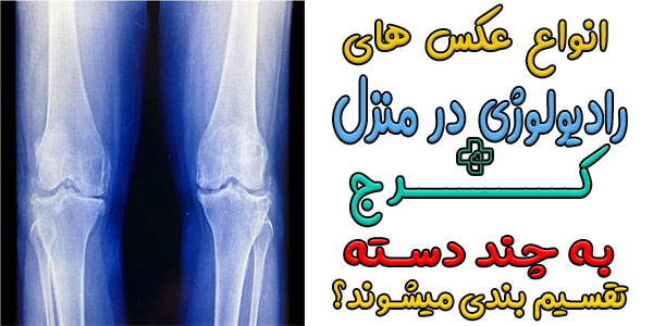 انواع تصاویر در انجام رادیولوژی در منزل کرج چیست؟