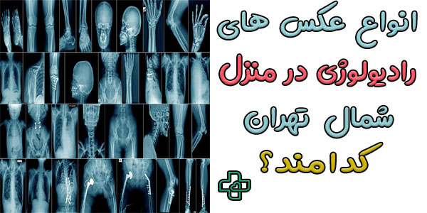 انواع تصویربرداری در ارائه خدمات رادیولوژی در منزل شمال تهران