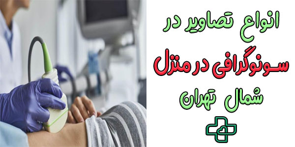 انواع تصویربرداری در سونوگرافی در منزل شمال تهران کدامند؟