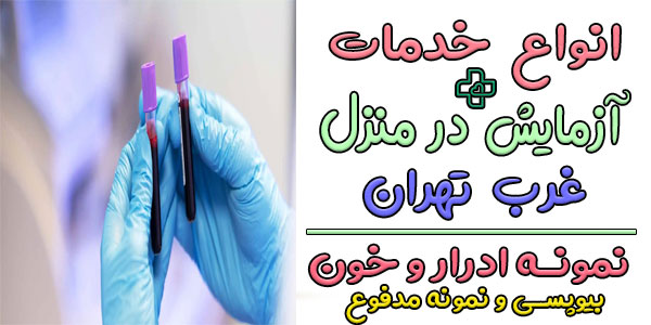 انواع خدمات آزمایش در منزل غرب تهران چند نوع است؟