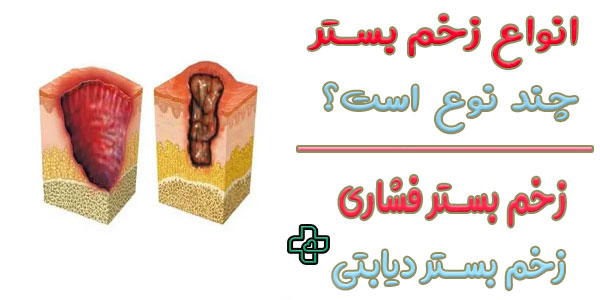 انواع زخم بستر از نظر علل ایجاد