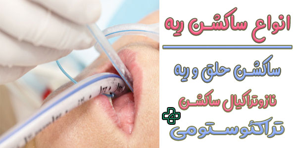 انواع ساکشن ریه از چند طریق امکانپذیر است؟