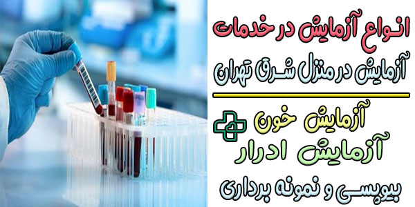انواع چکاپ در خدمات ازمایش در منزل شرق تهران کدامند؟