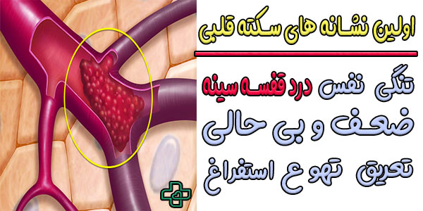 اولین نشانه های سکته قلبی به چه صورتی ظاهر می گردد؟