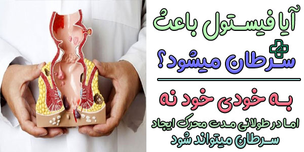 ایا فیستول باعث سرطان میشود؟