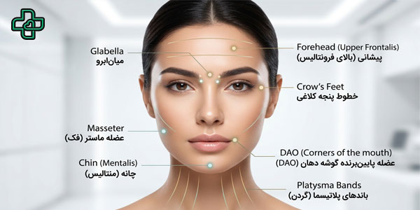برای آگاهی بیشتر شما؛ بهترین نقاط تزریق بوتاکس کدامند؟