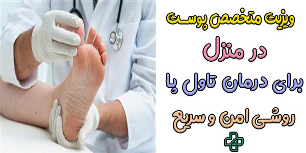 برای درمان تاول پا با ویزیت متخصص پوست در منزل