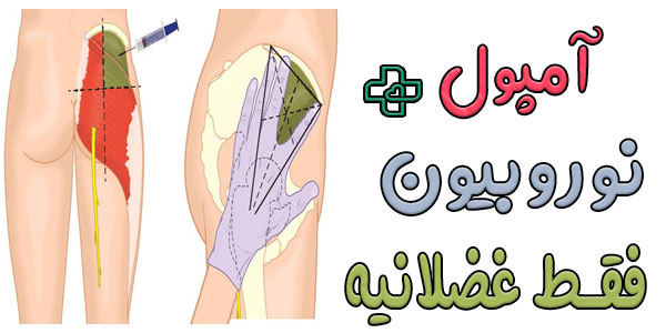 تزریق آمپول نوروبیون عضلانی است یا وریدی؟ 