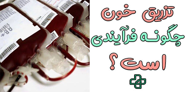 تزریق خون به بیمار چگونه فرآیندی است؟