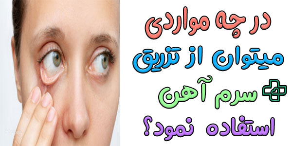 تزریق سرم آهن در چه مواردی مناسب تر است؟