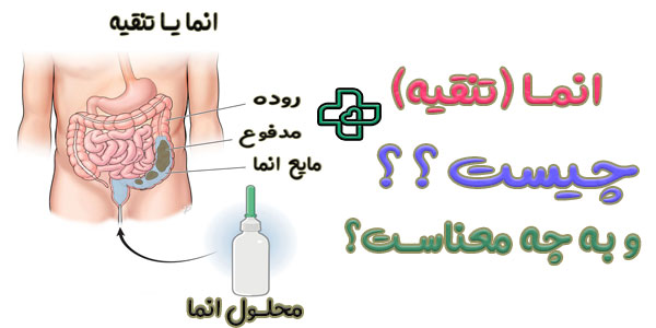 خدمات تنقیه در منزل چیست و به چه معناست؟