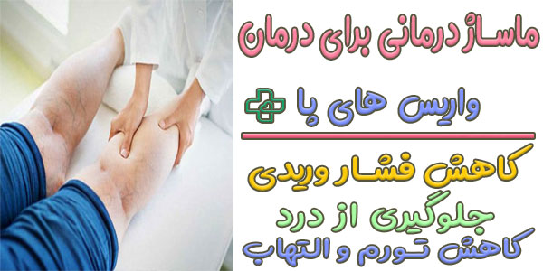 درمان خانگی واریس پا با دمنوش های گیاهی