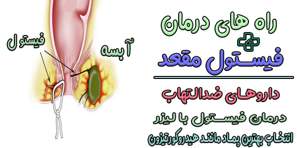 درمان قطعی فیستول مقعدی بدون جراحی