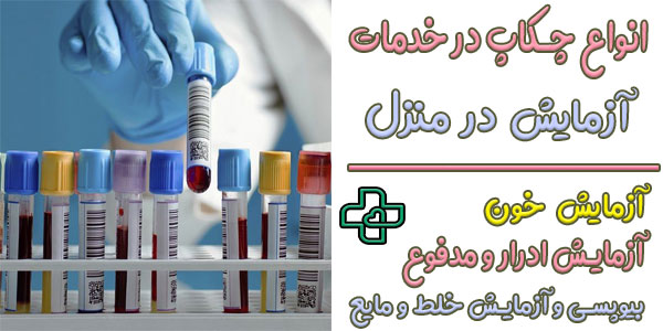 در خدمات آزمایش در منزل کدام آزمایش ها انجام می شود؟