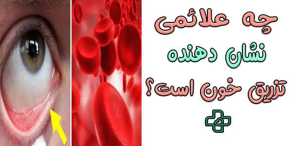 در چه علائمی نیاز به تزریق پکسل وجود دارد؟