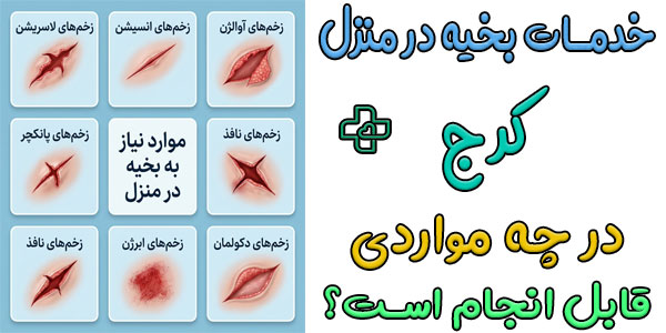 در چه مواردی میتوان از بخیه در منزل کرج استفاده نمود؟