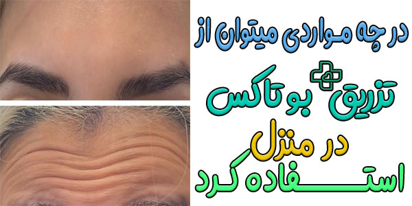 در چه مواردی می توان از بوتاکس در منزل استفاده کرد؟