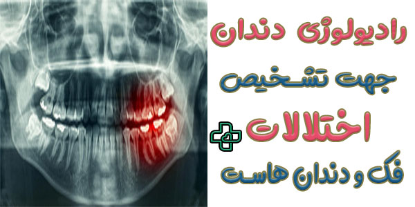 رادیولوژی دندان