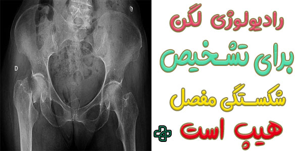 رادیولوژی لگن در منزل