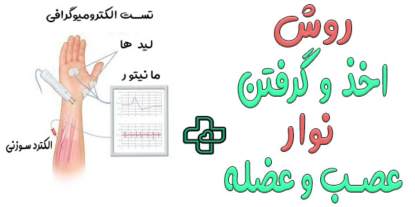 روش اخذ نوار عصب و عضله در منزل به چه صورتی است؟