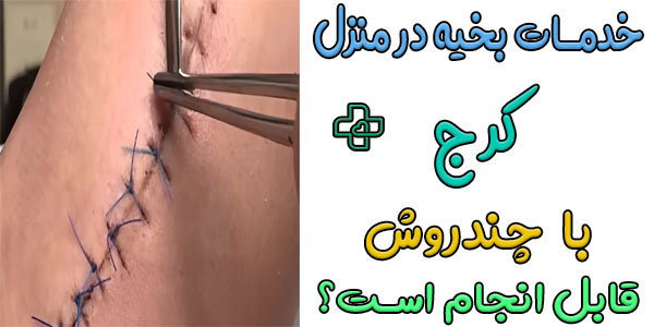 راهنمای انواع روش های انجام خدمات بخیه در منزل کرج (زدن و کشیدن) که بهتر است بدانید!